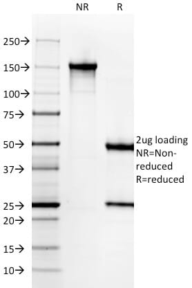 SDS-PAGE analysis of Anti-Gastrin Antibody [GAST/2631] under non-reduced and reduced conditions; showing intact IgG and intact heavy and light chains, respectively. SDS-PAGE analysis confirms the integrity and purity of the antibody.