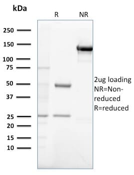 SDS-PAGE analysis of Anti-Gastrin Antibody [GAST/2632] under non-reduced and reduced conditions; showing intact IgG and intact heavy and light chains, respectively. SDS-PAGE analysis confirms the integrity and purity of the antibody.