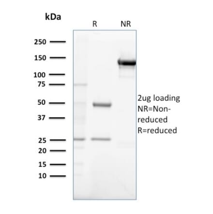 SDS-PAGE - Anti-Gastrin Antibody [GAST/2632] (A248656) - Antibodies.com