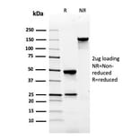 SDS-PAGE - Anti-Gastrin Antibody [GAST/2634] (A248659) - Antibodies.com