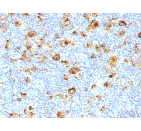 Immunohistochemistry - Anti-CD15 Antibody [MY-1] (A248663) - Antibodies.com