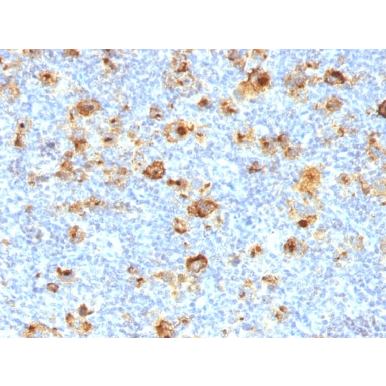 Immunohistochemistry - Anti-CD15 Antibody [MY-1] (A248663) - Antibodies.com