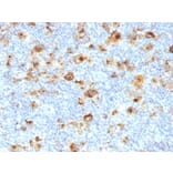 Immunohistochemistry - Anti-CD15 Antibody [MY-1] (A248663) - Antibodies.com