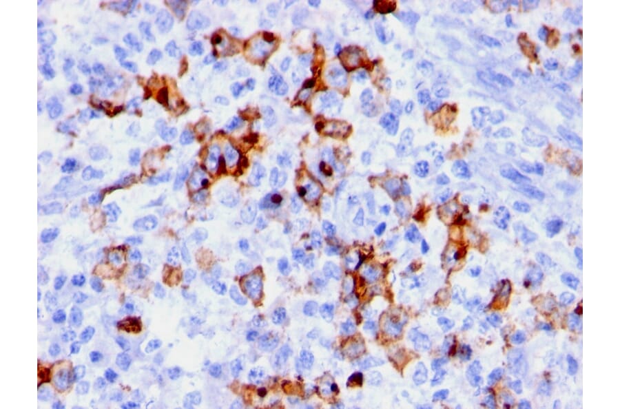 Immunohistochemistry - Anti-CD15 Antibody [BRA-4F1] (A248665) - Antibodies.com