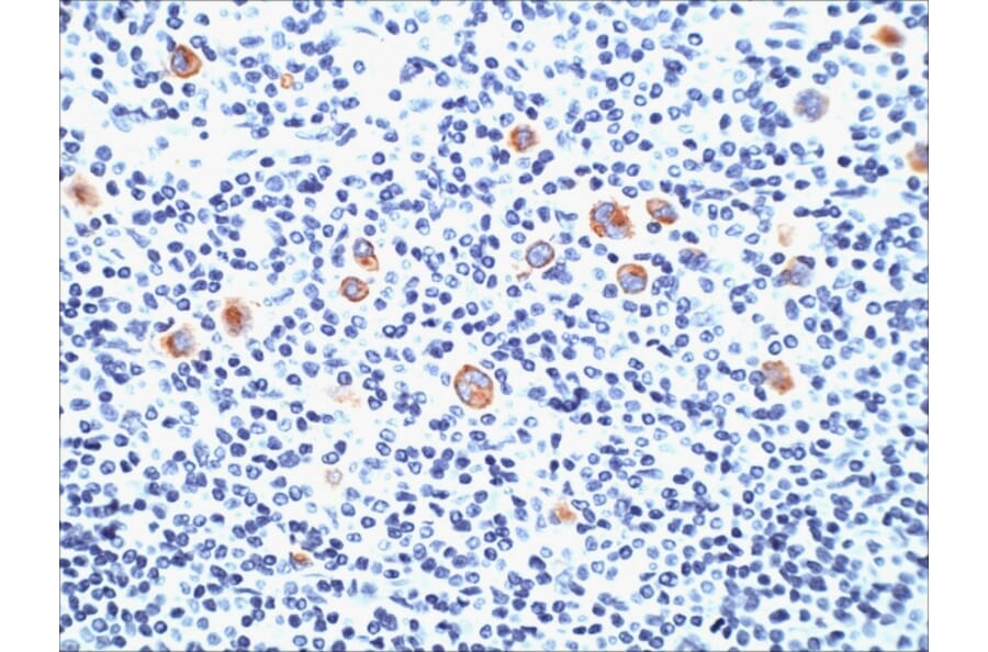 Immunohistochemistry - Anti-CD15 Antibody [SPM490] (A248668) - Antibodies.com