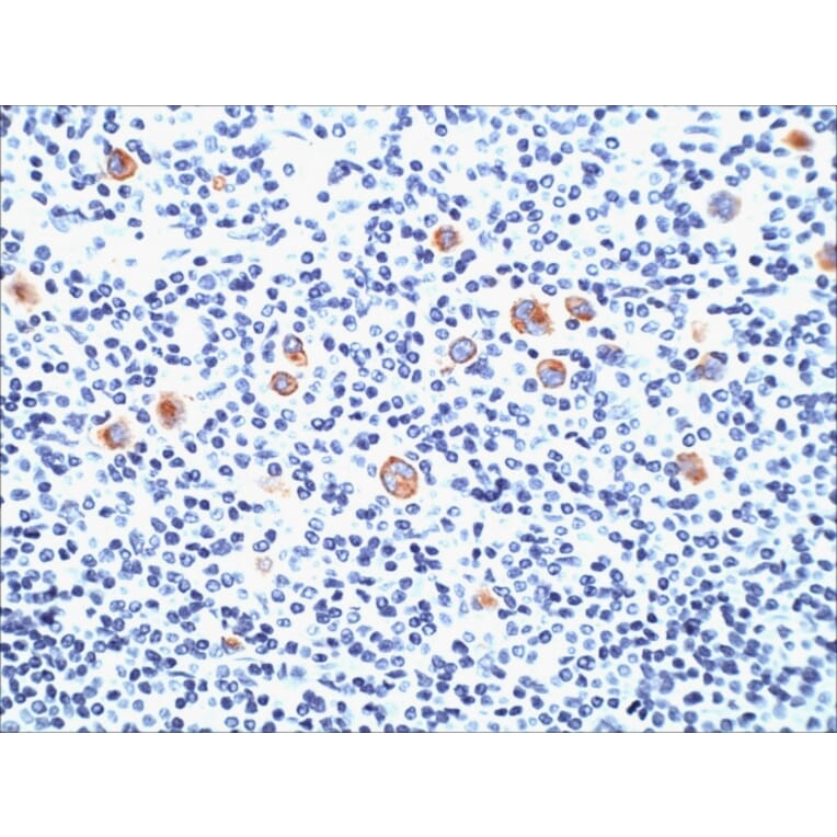 Immunohistochemistry - Anti-CD15 Antibody [SPM490] (A248668) - Antibodies.com