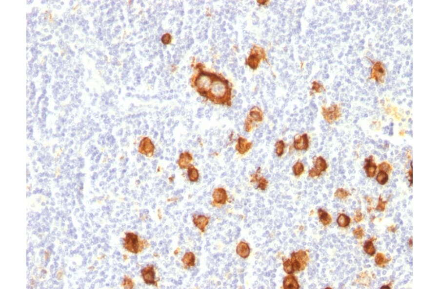 Immunohistochemistry - Anti-CD15 Antibody [FUT4/815] (A248669) - Antibodies.com