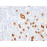 Immunohistochemistry - Anti-CD15 Antibody [FUT4/815] (A248669) - Antibodies.com