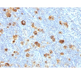 Immunohistochemistry - Anti-CD15 Antibody [FUT4/1478R] (A248671) - Antibodies.com