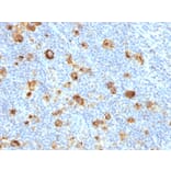 Immunohistochemistry - Anti-CD15 Antibody [FUT4/1478R] (A248671) - Antibodies.com