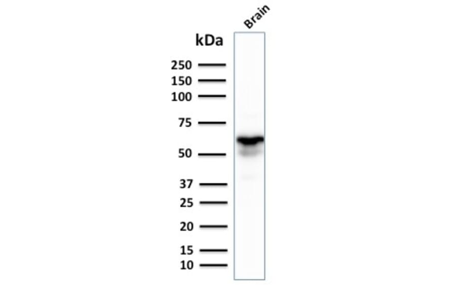 Western Blot - Anti-GAD67 Antibody [GAD1/2391] (A248674) - Antibodies.com