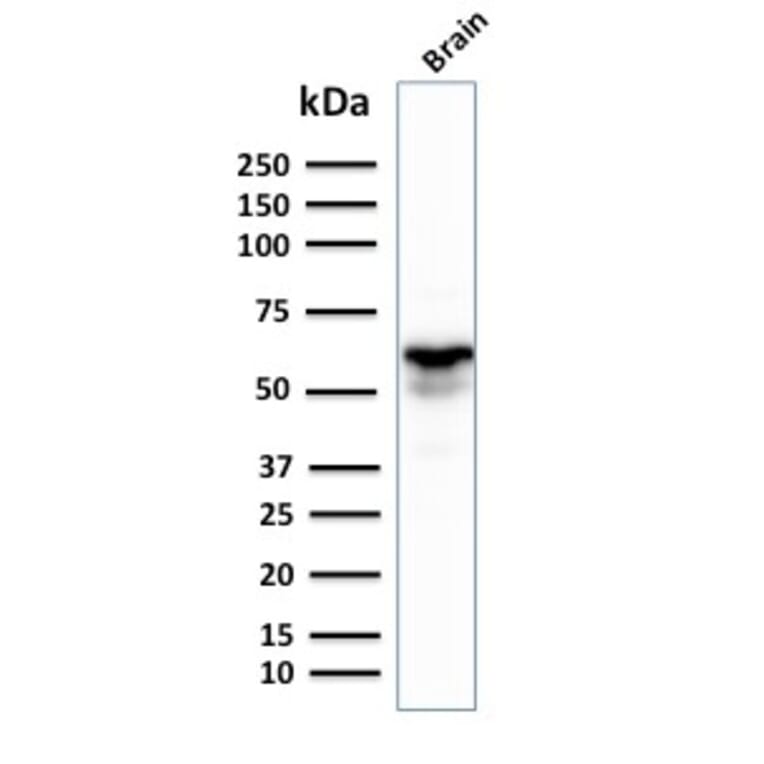 Western Blot - Anti-GAD67 Antibody [GAD1/2391] (A248674) - Antibodies.com