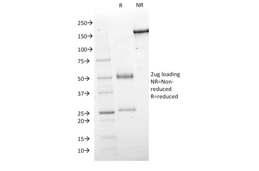 SDS-PAGE - Anti-GAD67 Antibody [GAD1/2563] (A248675) - Antibodies.com