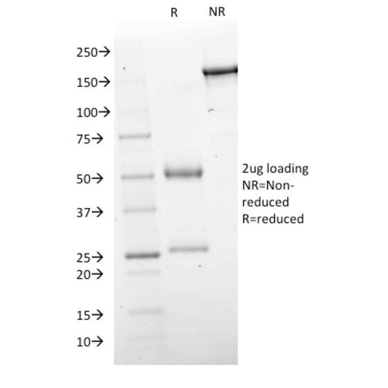 SDS-PAGE - Anti-GAD67 Antibody [GAD1/2563] (A248675) - Antibodies.com