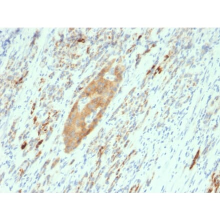 Immunohistochemistry - Anti-GAD65 Antibody [GAD2/2362] (A248677) - Antibodies.com