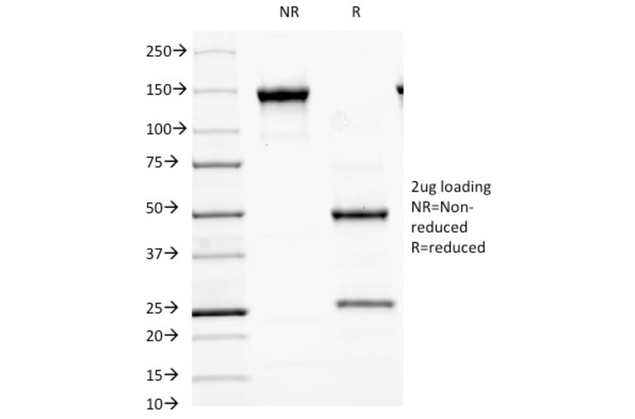 SDS-PAGE - Anti-GAD65 Antibody [GAD2/2362] (A248677) - Antibodies.com