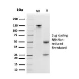 SDS-PAGE - Anti-Kallikrein 5 Antibody [KLK5/3841] (A248678) - Antibodies.com