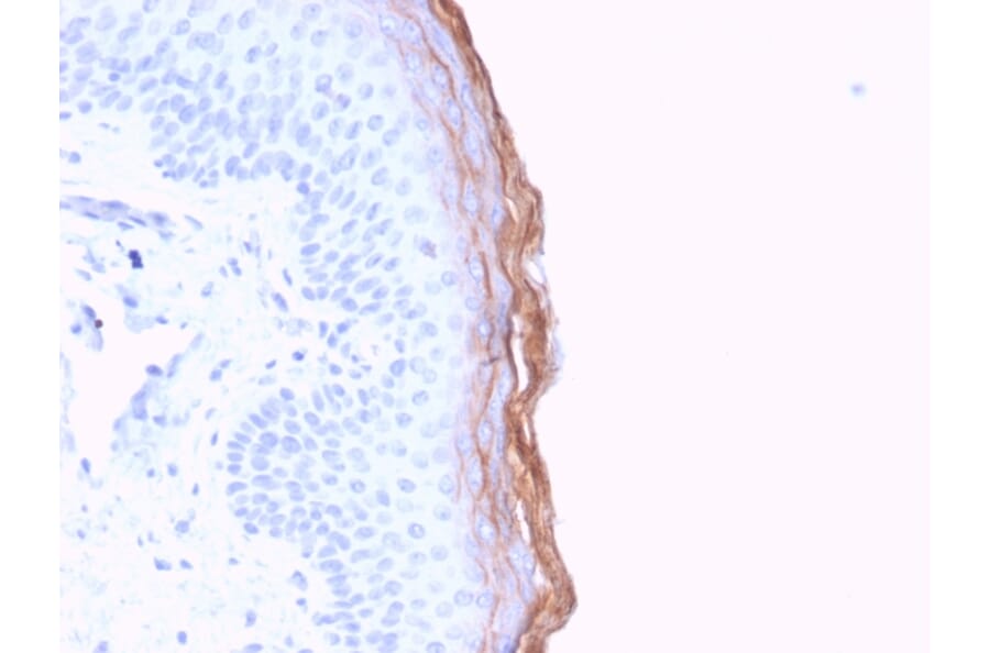 Immunohistochemistry - Anti-Kallikrein 5 Antibody [KLK5/3841] (A248678) - Antibodies.com
