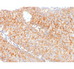 Immunohistochemistry - Anti-SERBP1 Antibody [SERBP1/3491] (A248682) - Antibodies.com