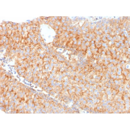 Immunohistochemistry - Anti-SERBP1 Antibody [SERBP1/3491] (A248682) - Antibodies.com