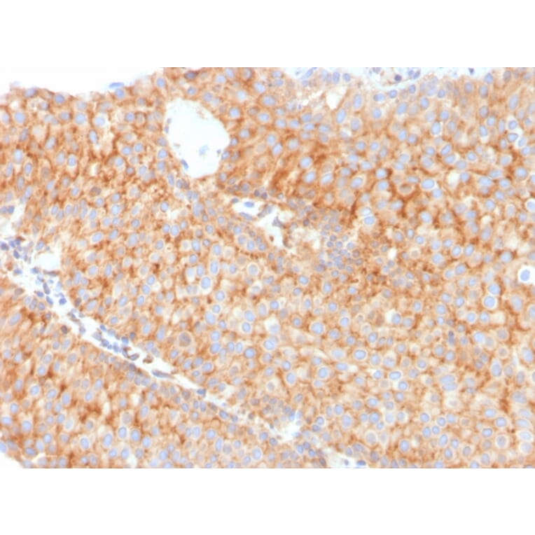 Immunohistochemistry - Anti-SERBP1 Antibody [SERBP1/3491] (A248682) - Antibodies.com