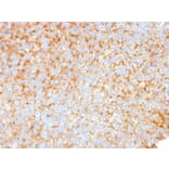 Immunohistochemistry - Anti-SERBP1 Antibody [SERBP1/3491] (A248682) - Antibodies.com