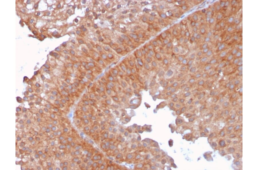 Immunohistochemistry - Anti-SERBP1 Antibody [SERBP1/3492] (A248683) - Antibodies.com