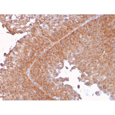 Immunohistochemistry - Anti-SERBP1 Antibody [SERBP1/3492] (A248683) - Antibodies.com