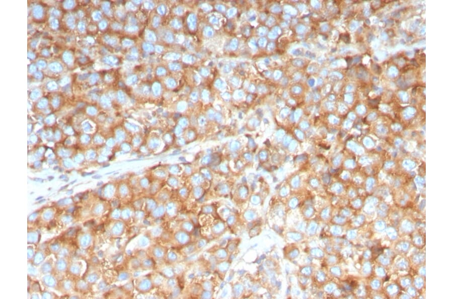Immunohistochemistry - Anti-SERBP1 Antibody [SERBP1/3492] (A248683) - Antibodies.com