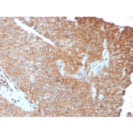 Immunohistochemistry - Anti-SERBP1 Antibody [SERBP1/3493] (A248684) - Antibodies.com