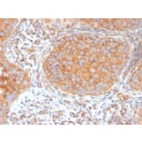 Immunohistochemistry - Anti-SERBP1 Antibody [SERBP1/3494] (A248685) - Antibodies.com