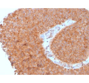 Immunohistochemistry - Anti-SERBP1 Antibody [SERBP1/3495] (A248686) - Antibodies.com