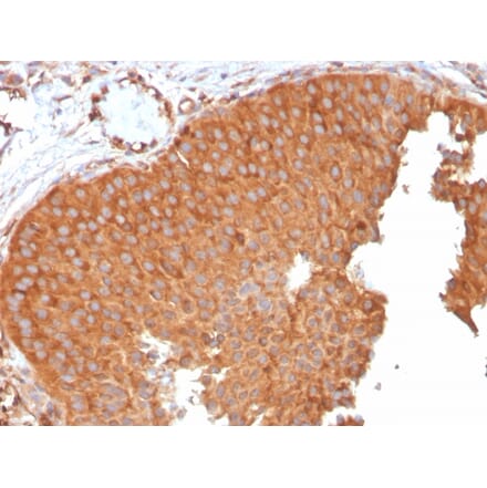 Immunohistochemistry - Anti-SERBP1 Antibody [SERBP1/3496] (A248687) - Antibodies.com