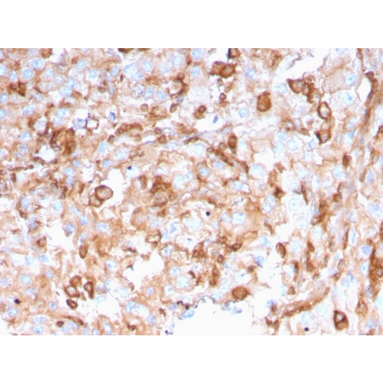 Immunohistochemistry - Anti-SERBP1 Antibody [SERBP1/3496] (A248687) - Antibodies.com