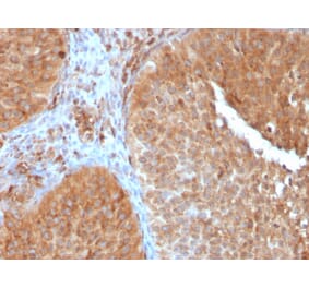 Immunohistochemistry - Anti-SERBP1 Antibody [SERBP1/3497] (A248688) - Antibodies.com