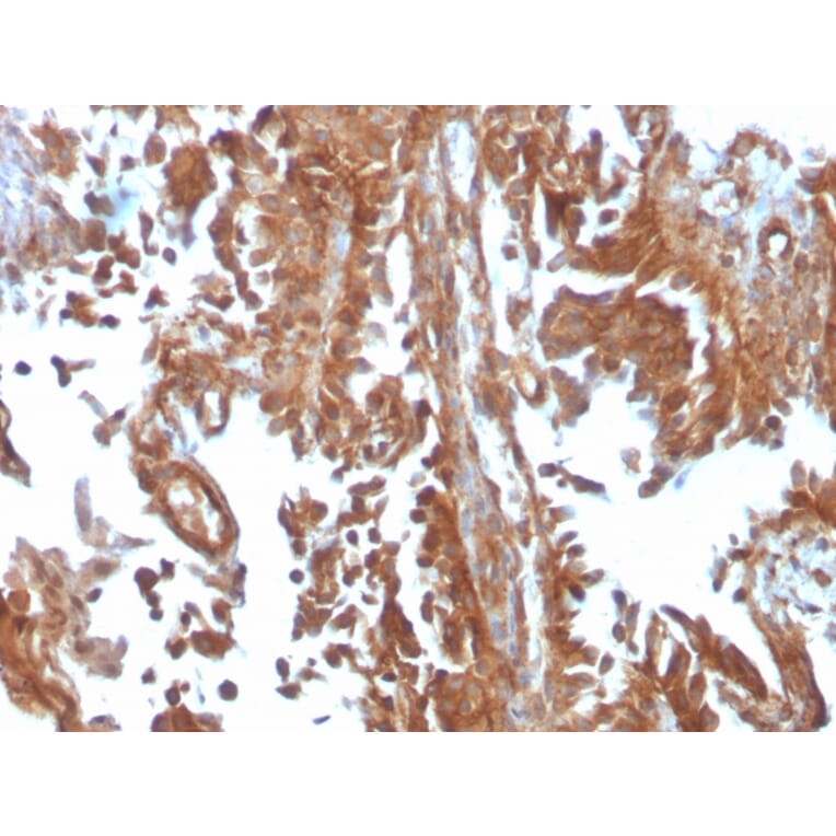 Immunohistochemistry - Anti-SERBP1 Antibody [SERBP1/3497] (A248688) - Antibodies.com