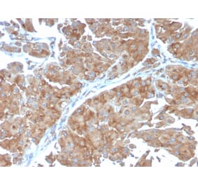 Immunohistochemistry - Anti-SERBP1 Antibody [SERBP1/3498] (A248689) - Antibodies.com