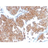 Immunohistochemistry - Anti-SERBP1 Antibody [SERBP1/3498] (A248689) - Antibodies.com