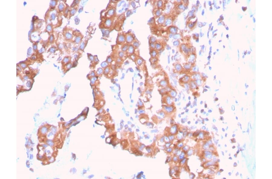 Immunohistochemistry - Anti-SERBP1 Antibody [SERBP1/3509] (A248690) - Antibodies.com