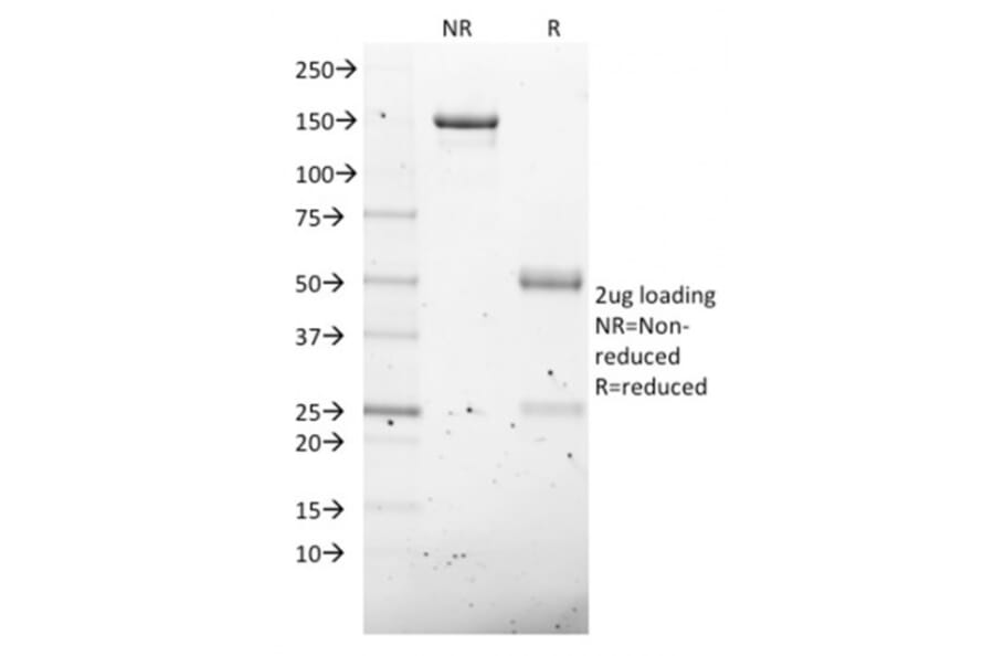 SDS-PAGE - Anti-NKX2.8 Antibody [NKX28/2547] (A248690) - Antibodies.com