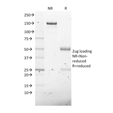 SDS-PAGE - Anti-NKX2.8 Antibody [NKX28/2547] (A248690) - Antibodies.com