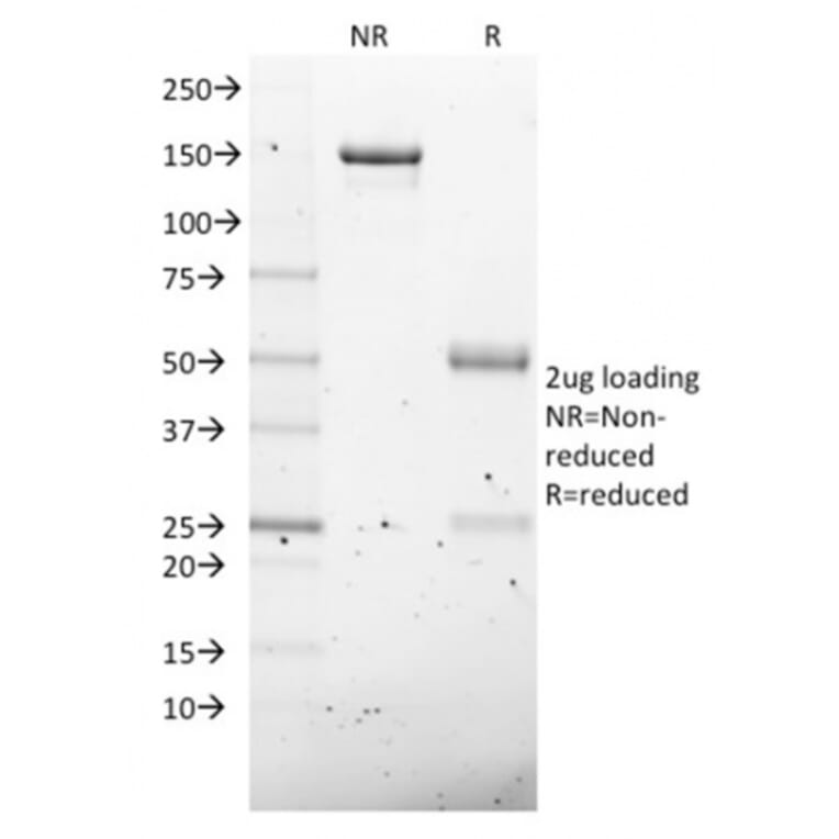 SDS-PAGE - Anti-NKX2.8 Antibody [NKX28/2547] (A248690) - Antibodies.com