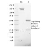 SDS-PAGE - Anti-NKX2.8 Antibody [NKX28/2547] (A248690) - Antibodies.com