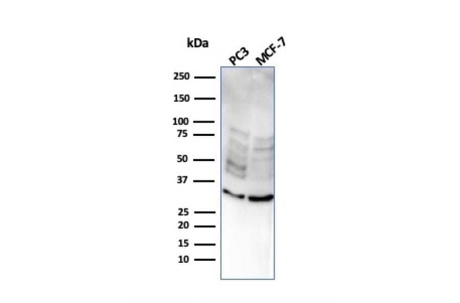 Western Blot - Anti-NKX2.8 Antibody [NKX28/2547] (A248691) - Antibodies.com