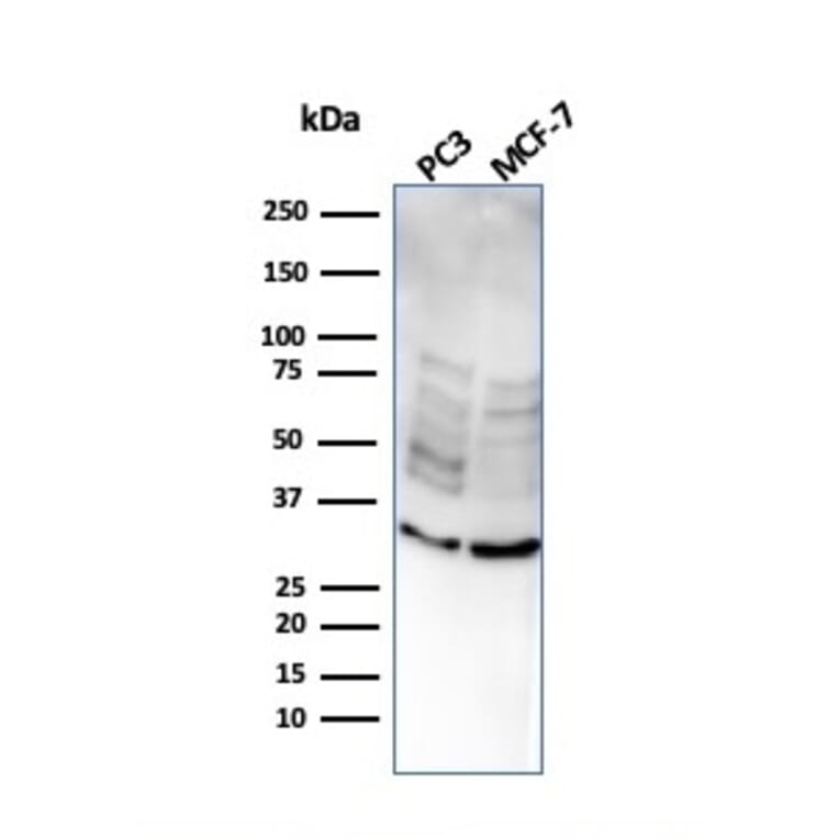 Western Blot - Anti-NKX2.8 Antibody [NKX28/2547] (A248691) - Antibodies.com