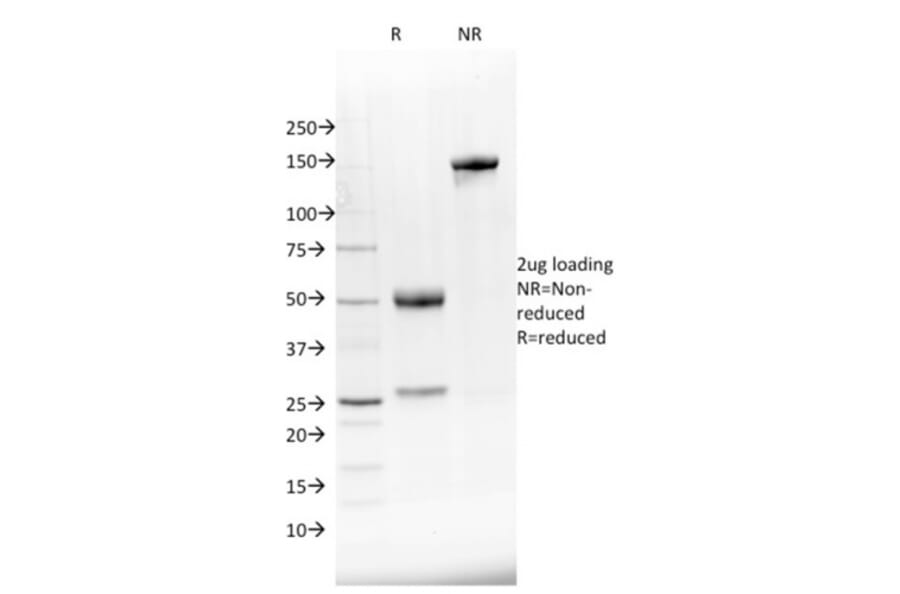SDS-PAGE - Anti-NKX2.8 Antibody [NKX28/2548] (A248691) - Antibodies.com