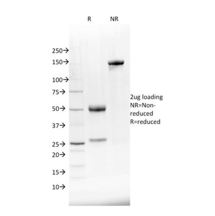 SDS-PAGE - Anti-NKX2.8 Antibody [NKX28/2548] (A248691) - Antibodies.com