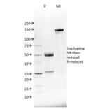 SDS-PAGE - Anti-NKX2.8 Antibody [NKX28/2548] (A248691) - Antibodies.com