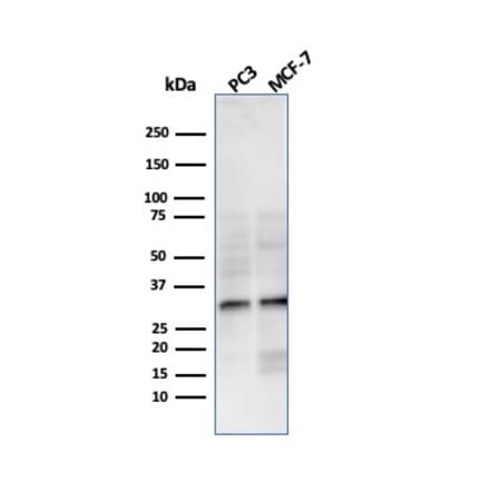 Western Blot - Anti-NKX2.8 Antibody [NKX28/3233R] (A248692) - Antibodies.com