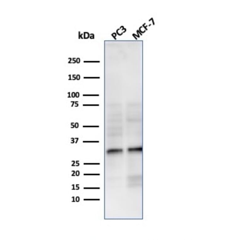Western Blot - Anti-NKX2.8 Antibody [NKX28/3233R] (A248692) - Antibodies.com